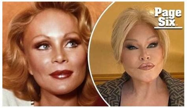 Catwoman Jocelyn Wildenstein