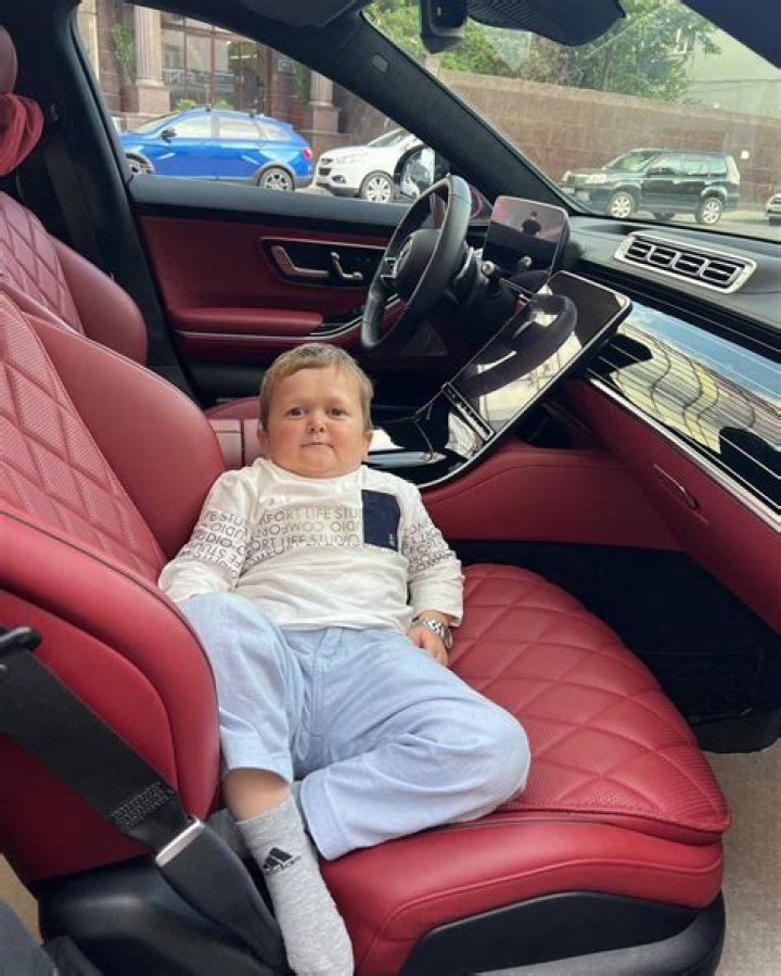 Unveiling The Secrets Of Hasbulla Genetic Condition: Groundbreaking Discoveries And Insights