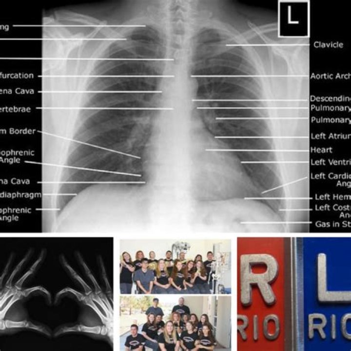 How hard is radiology tech school