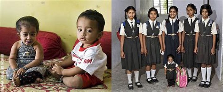 Discover Jyoti Amge's Inspiring Journey: Unlocking Potential, Embracing Differences