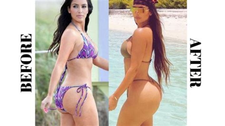 Kim K's Transformation: Before And After BBL