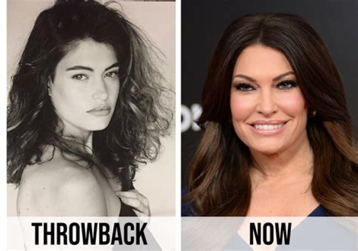 The Truth About Kimberly Guilfoyle's Plastic Surgery Journey