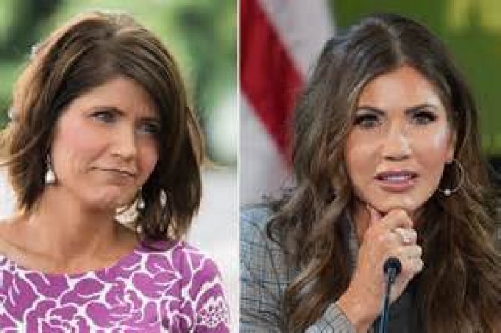 Kristi Noem's Cosmetic Surgery Journey